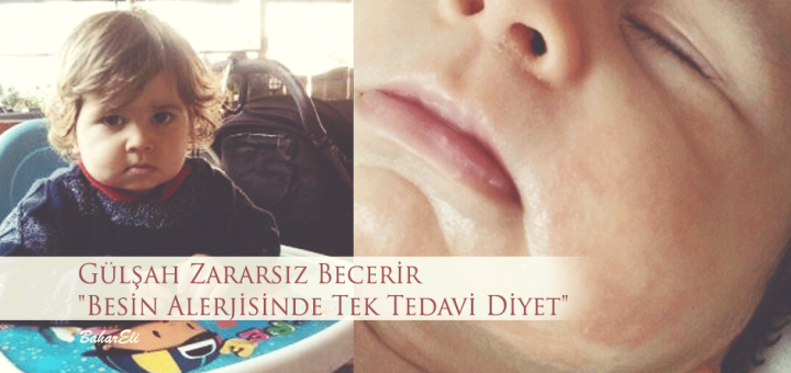 Gülşah Zararsız Becerir ile Besin Alerjisi üzerine röportaj